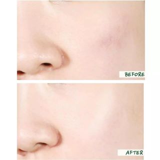 Tinh Chất Dưỡng Da Sweeteen 150Ml Chất Lượng Cao