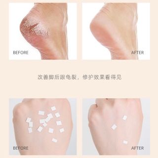 Kem trị nứt nẻ da Heyxi
