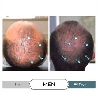 Serum giảm gãy, rụng, kích thích mọc tóc SPECTRAL.F7 60ml của Ds Laboratories ( Mỹ )