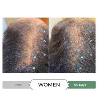 Dầu sả chống oxy hóa, kích thích mọc tóc REVITA.CBD CONDITIONER  205ML
