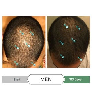 Serum giảm gãy, rụng, giảm gàu, kích thích mọc tóc SPECTRAL.CBD 60ml của Ds Laboratories ( Mỹ )