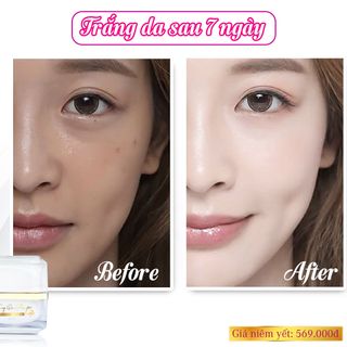 FACE TRẮNG DA MẶT PHÁP AN TOÀN giá sỉ