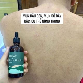 Serum Truật Thảo Hoa