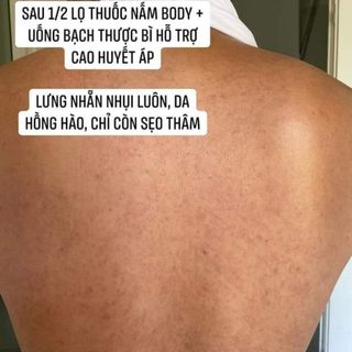 Serum Truật Thảo Hoa