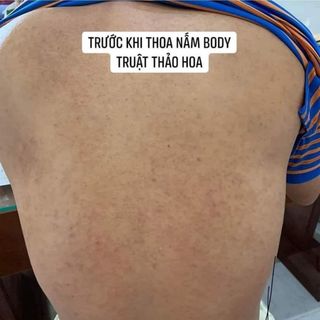 Serum Truật Thảo Hoa