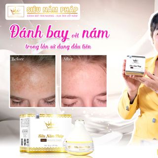 KEM TRIỆT SIÊU NÁM ẨN PHÁP COSMETICS giá sỉ
