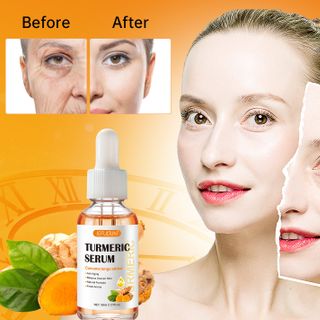 Serum Turmeric Nghệ giảm thâm mụn ,loại trừ nám giúp da xe khích lỗ chân lông