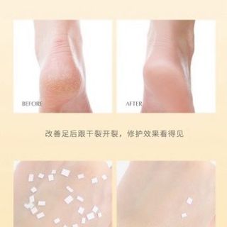 Kem Chống Nẻ - Kem Dưỡng Ẩm Chống Nứt Nẻ Da Heyxi 20g HGNN60ML