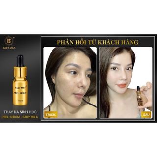 [Hot] Thay Da Sinh Học Peel Serum Baby Milk 10ml - Hàng Hiệu Vũ Phạm