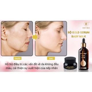 [Hot] Bộ Gold Serum - Baby Milk, Dưỡng Trắng Da, Đánh Bay Nám Mụn - Hàng Hiệu Vũ Phạm