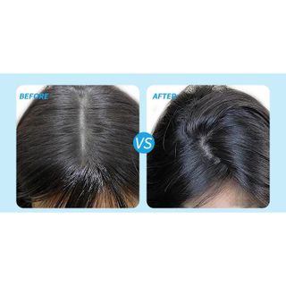 Dầu Gội Khô Dạng Xịt Tạo Độ Phồng Bồng Bềnh Cho Tóc