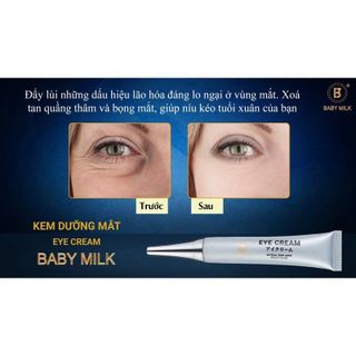 [Hot] Kem Dưỡng Mắt Eye Cream Baby Milk - Hàng Hiệu Vũ Phạm