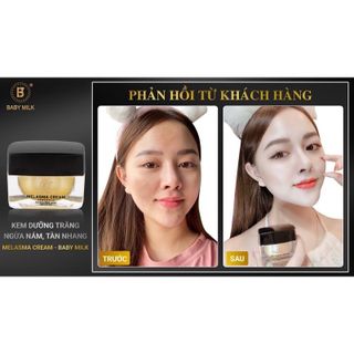 [Hot] Kem Dưỡng Trắng Nâng Cơ Ngăn Ngừa Nám Tàn Nhang MelasMa Cream Baby Milk 30g - Hàng Hiệu Vũ Phạm