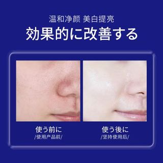 Sửa Rửa Mặt Công Nghệ Nhật Bản UCM giupa trắng da , làm sạch bụi bẩn , ngăn ngừa mụn