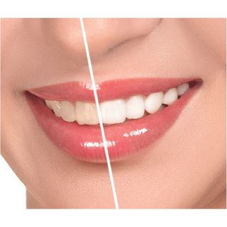 Kem và Bột Đánh Răng Làm Trắng Răng bán buôn bán sỉ