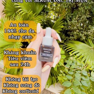 Trị mụn princess