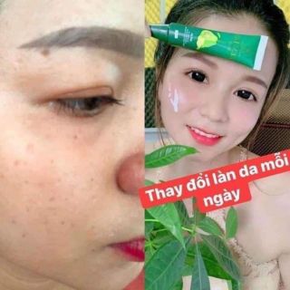 KEM BƠ CẤY TRẮNG NANO OLIC DƯỠNG TRẮNG DA