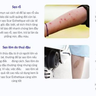 Kem xóa Sẹo Thâm, lấp đầy Sẹo Rỗ, Sẹo Lõm Scar Esthetique 10ml của Rejuvaskin