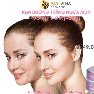 [Chính Hãng] Kem Holy Care Mụn Hồng 20g