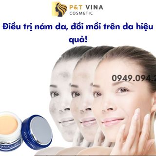 [Chính Hãng] Kem Holy Care Dưỡng Trắng Da Ngừa Nám (Holy Care Xanh Dương) giá sỉ