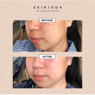 Serum centalla chai 55ml Chính hãng 100%