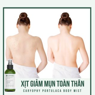 Xịt Giảm Mụn Lưng Caryophy Portulaca Body Mist giảm mụn, mờ thâm, sáng da toàn thân 150ml