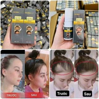 XỊT KÍCH MỌC TÓC FEG