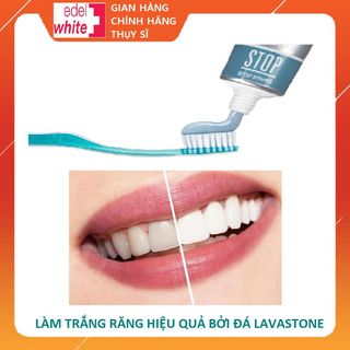 Kem đánh răng siêu trắng STOP Stains Whitening Thụy sĩ, 75ml giúp trắng răng, loại bỏ cao răng
