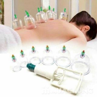 BỘ GIÁC HƠI giá sỉ