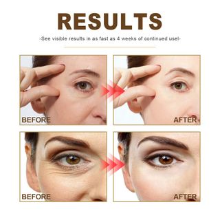 Tinh Chất Collagen Anti-Wrinkle Dưỡng ẩm làm căng da, chống lão hóa, chống nhăn, làm mờ vết nám, và tinh chất trẻ hoá