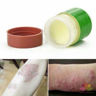 Hủ kem 29A Bôi Ngoài Da Nấm Lang Ben chính hãng Thái Lan 7,5gr