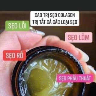 Gel trị sẹo cao sâm nghệ Collagen (15gr)
(Nhập số lượng lớn có giá ưu đãi hơn )