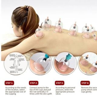 BỘ GIÁC HƠI 12 ỐNG HÚT CHÂN KHÔNG