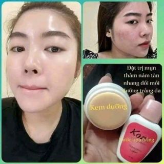 kem KONE THÁI LAN giá sỉ