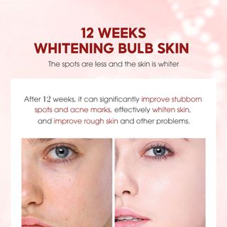 Niacinamide Serum Skin Ever Essence Dưỡng Phục hồi da chuyên sâu , tăng cường chống lão hóa giúp da khỏe loại bỏ các vết sạm
