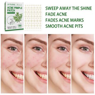 Miếng Dán Trị Mụn Trà Xanh tea tree Oil làm giảm mụn thâm, trị mụn (1hop/144mieng)