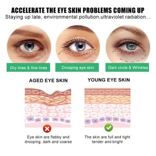 Kem Dưỡng Mắt RETINOL Ngày Đêm ,Cải Thiện Lão Hóa, khắc Phục Thâm Quần mắt 50ml