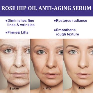 Serum Restore Skin Cải Thiện vết nhăn, chống lão hóa, giúp da chắc khỏe, đánh bại đồi môig vết sạm trên da 30ml