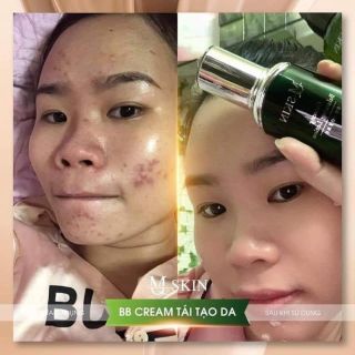 Tái tạo bb cream mqskin