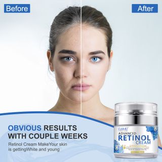Kem RETINOL Đặc Trị Ngăn Ngừa Lão Hóa 50ml