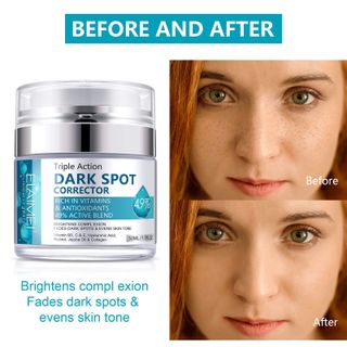 Kem DARK SPOT Triple Action điều trị thâm nám, ngăn ngừa mụn thâm và sắc tố da 50ml