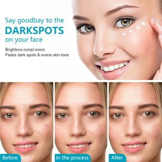 Kem DARK SPOT Triple Action điều trị thâm nám, ngăn ngừa mụn thâm và sắc tố da 50ml