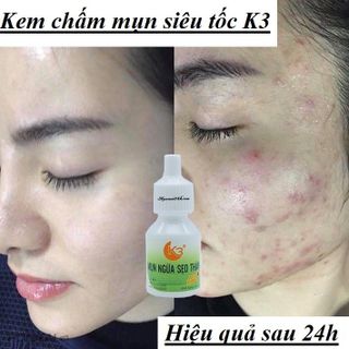 Kem chấm mụn K3 giúp giảm mụn, làm mờ sẹo, thâm hiệu quả 10g