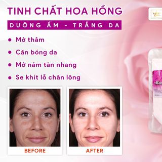 🌹 DẺO HOA HỒNG 🌹 Mask dẻo đắp mặt hương Hoa Hồng Phap Cosmetic