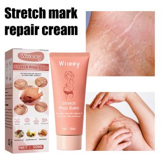 Kem Chuyên Trị Rạn Da , Trị Sẹo , Trị Thâm Cho Các Vấn Đề Về Da 50ml