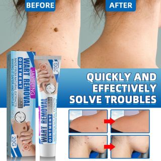 Kem Chuyên Trị Mụn Thịt, Mụn Cóc , Đồi Mồi , Nám , Tàn Nhang cùng các vấn đề về da 20g