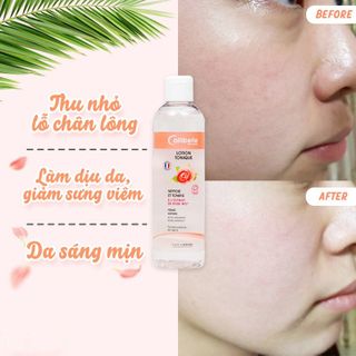 Nước hoa hồng hữu cơ Callibelle dưỡng da, tái tạo da và se khít lỗ chân lông 250ml