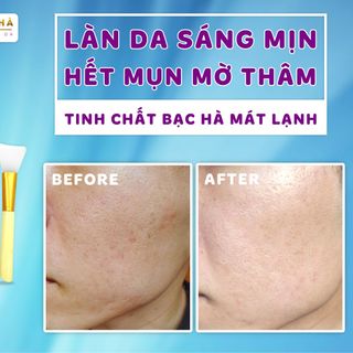 . MASK DẺO BẠC HÀ , sản phẩm chuyên dụng trong các Spa cao cấp nè các chị đẹp ơi, ĐẮP TỚI ĐÂU MÁT LẠNH TỚI ĐÓ