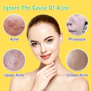 Mặt Nạ Chuối Vitamin E Đặc Trị Ngăn Ngừa Về Các Vấn đề Mụn , Giảm Thâm mụn , Cung Cấp Hoạt Chất Giúp da khoẻ ( 1hop/10mieng )