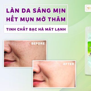 MASK DẺO BẠC HÀ 100gr , sản phẩm chuyên dụng trong các Spa cao cấp nè các chị đẹp ơi, ĐẮP TỚI ĐÂU MÁT LẠNH TỚI ĐÓ!! giá sỉ